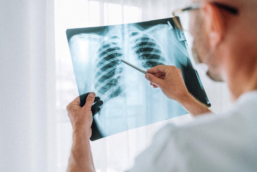 Medical specialist wearing glasses holding up and reviewing a patient’s x-ray