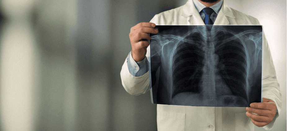 Radiologist wearing a blouse and blue tie holding a medical image