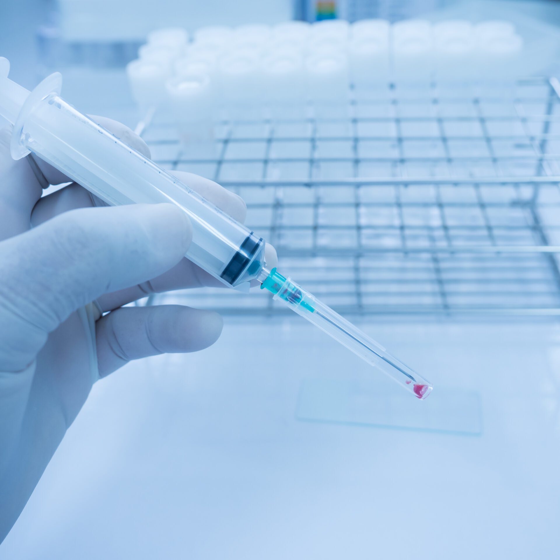 Close,Up,Doctor,Hand,Holding,Syringe,During,Smear,Fine,Needle Close,Up,Doctor,Hand,Holding,Syringe,During,Smear,Fine,Needle