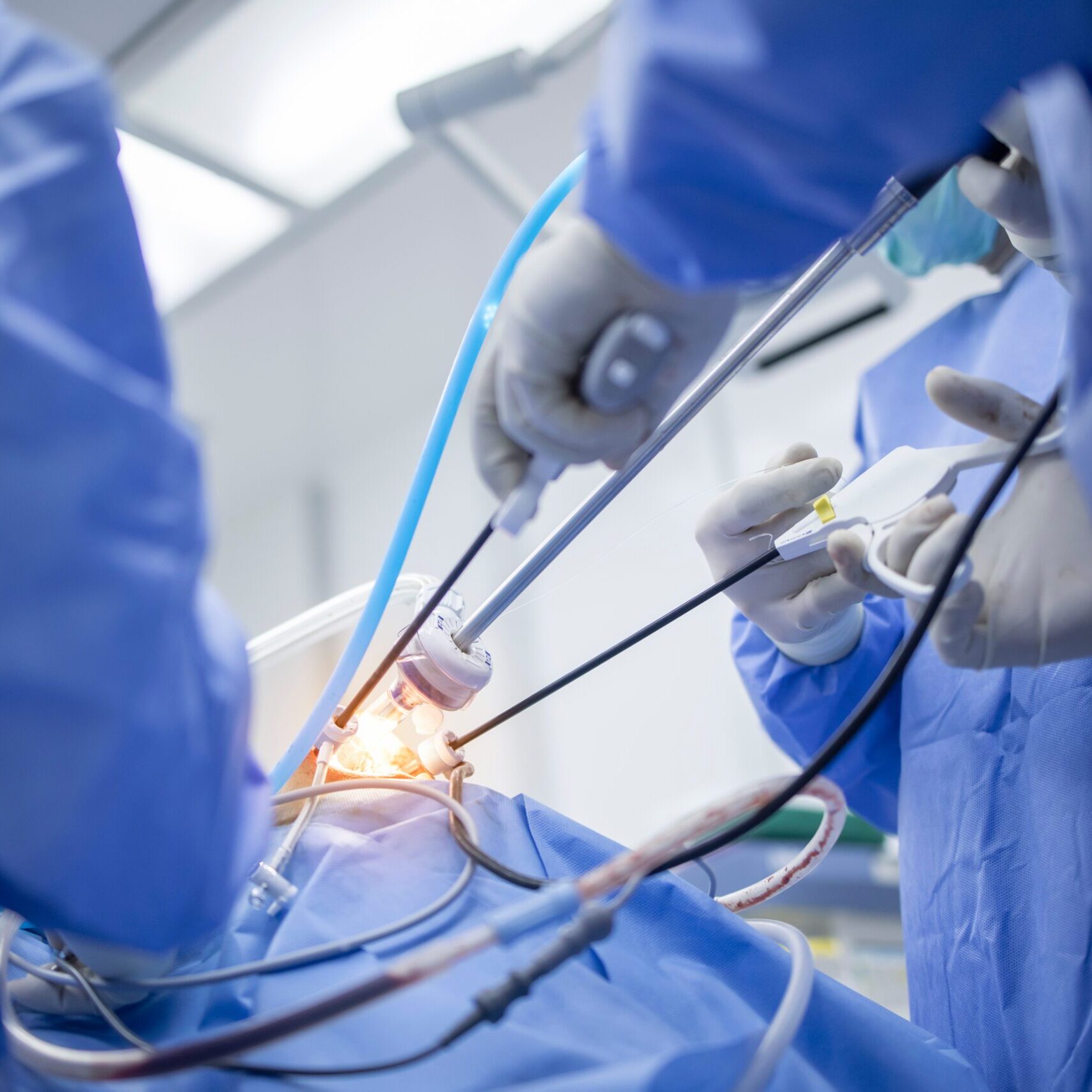 Close,Up,Photo,Of,Keyhole,Thyroid,Surgery.minimal,Invasive,Surgery,Was Close,Up,Photo,Of,Keyhole,Thyroid,Surgery.minimal,Invasive,Surgery,Was